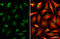 Small Nuclear Ribonucleoprotein Polypeptides B And B1 antibody, GTX101883, GeneTex, Immunofluorescence image 