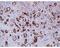 Complement C4-A antibody, MA5-18044, Invitrogen Antibodies, Immunohistochemistry frozen image 