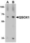 Quiescin Sulfhydryl Oxidase 1 antibody, MBS153698, MyBioSource, Western Blot image 