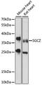 Sarcoglycan Zeta antibody, 16-345, ProSci, Western Blot image 