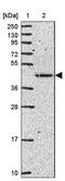 Fucosyltransferase 10 antibody, PA5-62887, Invitrogen Antibodies, Western Blot image 