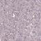 Zinc finger protein neuro-d4 antibody, HPA049148, Atlas Antibodies, Immunohistochemistry paraffin image 