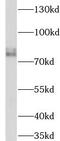 Lysyl oxidase homolog 2 antibody, FNab10512, FineTest, Western Blot image 