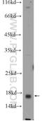 O-Acyl-ADP-Ribose Deacylase 1 antibody, 25249-1-AP, Proteintech Group, Western Blot image 