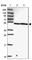 ZFP3 Zinc Finger Protein antibody, HPA053085, Atlas Antibodies, Western Blot image 