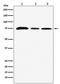 Lysine Acetyltransferase 7 antibody, M03896, Boster Biological Technology, Western Blot image 
