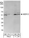 WD Repeat Domain 12 antibody, A302-650A, Bethyl Labs, Western Blot image 