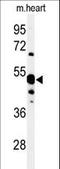 5'-Nucleotidase, Cytosolic IA antibody, LS-C155813, Lifespan Biosciences, Western Blot image 
