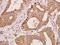 Far Upstream Element Binding Protein 3 antibody, A08695-1, Boster Biological Technology, Immunohistochemistry paraffin image 