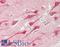 Maternal Embryonic Leucine Zipper Kinase antibody, LS-B14117, Lifespan Biosciences, Immunohistochemistry paraffin image 