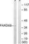 Partitioning defective 6 homolog beta antibody, A08475, Boster Biological Technology, Western Blot image 