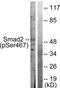 HsMAD2 antibody, LS-C199582, Lifespan Biosciences, Western Blot image 