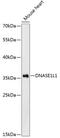 Deoxyribonuclease-1-like 1 antibody, 14-819, ProSci, Western Blot image 