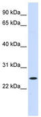 Nucleolar Protein 3 antibody, TA330416, Origene, Western Blot image 