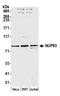 Nucleoporin 93 antibody, A303-979A, Bethyl Labs, Western Blot image 