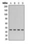 Pentraxin-related protein PTX3 antibody, orb393144, Biorbyt, Western Blot image 
