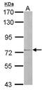Interleukin 17 Receptor D antibody, LS-C109393, Lifespan Biosciences, Western Blot image 