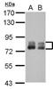 Phospholipase A2 Activating Protein antibody, NBP2-19858, Novus Biologicals, Western Blot image 