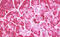 Microtubule Associated Protein 1 Light Chain 3 Beta antibody, MBS248659, MyBioSource, Immunohistochemistry paraffin image 