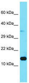 Late Endosomal/Lysosomal Adaptor, MAPK And MTOR Activator 3 antibody, TA342911, Origene, Western Blot image 