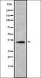 Arrestin Domain Containing 4 antibody, orb378235, Biorbyt, Western Blot image 