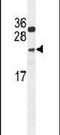 Nudix Hydrolase 15 antibody, PA5-24507, Invitrogen Antibodies, Western Blot image 