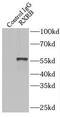 Retinoid X Receptor Beta antibody, FNab07544, FineTest, Immunoprecipitation image 
