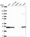 RAB8B, Member RAS Oncogene Family antibody, HPA074534, Atlas Antibodies, Western Blot image 