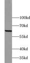 Zinc finger protein 395 antibody, FNab09695, FineTest, Western Blot image 