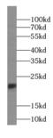 RB Binding Protein 9, Serine Hydrolase antibody, FNab07156, FineTest, Western Blot image 