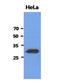 SBDS Ribosome Maturation Factor antibody, LS-C175816, Lifespan Biosciences, Western Blot image 