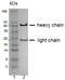 CD81 Molecule antibody, AP32979PU-N, Origene, Western Blot image 