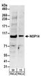 Nucleolar protein 14 antibody, NBP2-22227, Novus Biologicals, Western Blot image 