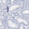 Spermatogenesis Associated 3 antibody, PA5-53765, Invitrogen Antibodies, Immunohistochemistry paraffin image 