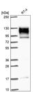 Erythrocyte Membrane Protein Band 4.1 Like 1 antibody, HPA054104, Atlas Antibodies, Western Blot image 