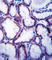 Solute carrier family 22 member 1 antibody, abx027700, Abbexa, Western Blot image 