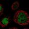 Chromodomain Y Like 2 antibody, NBP1-83470, Novus Biologicals, Immunocytochemistry image 