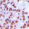 H2A Histone Family Member X antibody, LS-C368744, Lifespan Biosciences, Immunohistochemistry paraffin image 