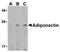 Adiponectin, C1Q And Collagen Domain Containing antibody, SP2182P, Origene, Western Blot image 