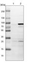 Poly(ADP-Ribose) Polymerase Family Member 6 antibody, PA5-55475, Invitrogen Antibodies, Western Blot image 