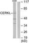 Ceramide Kinase Like antibody, TA316391, Origene, Western Blot image 
