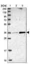 Multivesicular Body Subunit 12B antibody, PA5-60468, Invitrogen Antibodies, Western Blot image 