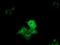 Cytoplasmic dynein 1 light intermediate chain 1 antibody, NBP2-45682, Novus Biologicals, Immunofluorescence image 