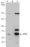 Serine/Threonine Kinase 4 antibody, NBP1-31233, Novus Biologicals, Immunoprecipitation image 