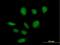 Zinc Finger And BTB Domain Containing 39 antibody, H00009880-B01P, Novus Biologicals, Immunofluorescence image 