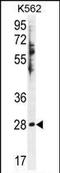 Hydroxysteroid 11-Beta Dehydrogenase 1 Like antibody, PA5-35049, Invitrogen Antibodies, Western Blot image 