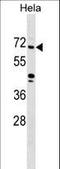 Zinc Finger Protein 280B antibody, LS-C157432, Lifespan Biosciences, Western Blot image 