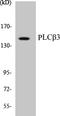Phospholipase C Beta 3 antibody, EKC1475, Boster Biological Technology, Western Blot image 