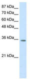 Homeobox D4 antibody, TA343746, Origene, Western Blot image 