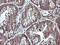 Cell Division Cycle 123 antibody, LS-C174457, Lifespan Biosciences, Immunohistochemistry paraffin image 